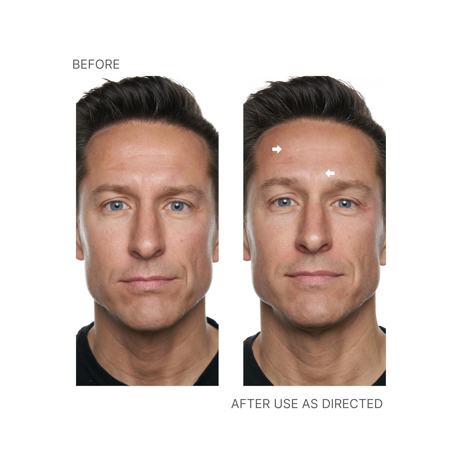 imageNu Skin  Face Lift with Activator Original Formula  Helps Lift and Tighten Your Face and Neck for a Youthful Firm Appearance Reducing Lines and Wrinkles Enhancing Skin Tone and Texture