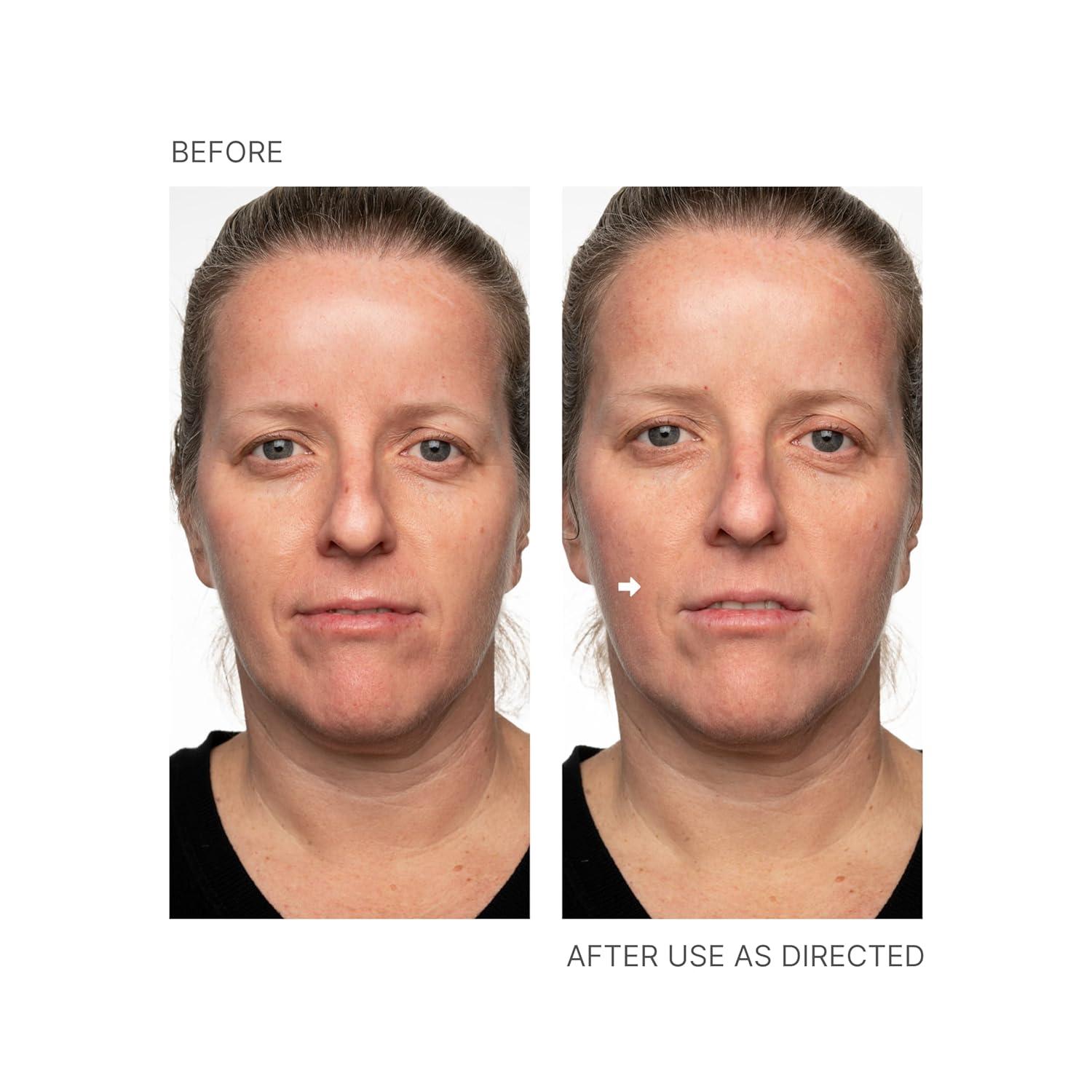 imageNu Skin  Face Lift with Activator Original Formula  Helps Lift and Tighten Your Face and Neck for a Youthful Firm Appearance Reducing Lines and Wrinkles Enhancing Skin Tone and Texture