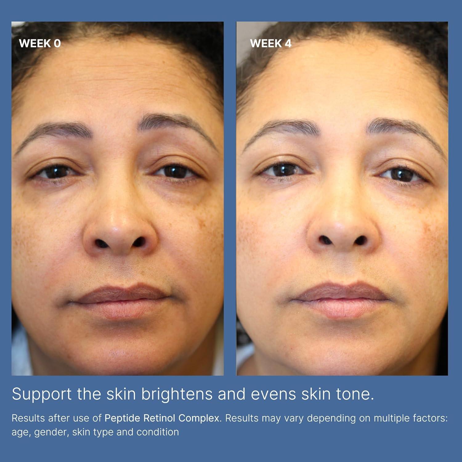 imageNu Skin  ageLOC Tru Face Peptide Retinol Complex  1 Fl Oz  Serum Skincare  Anti Aging Face Serum  Pore Minimizing  Peptide Facial Skin Care Product