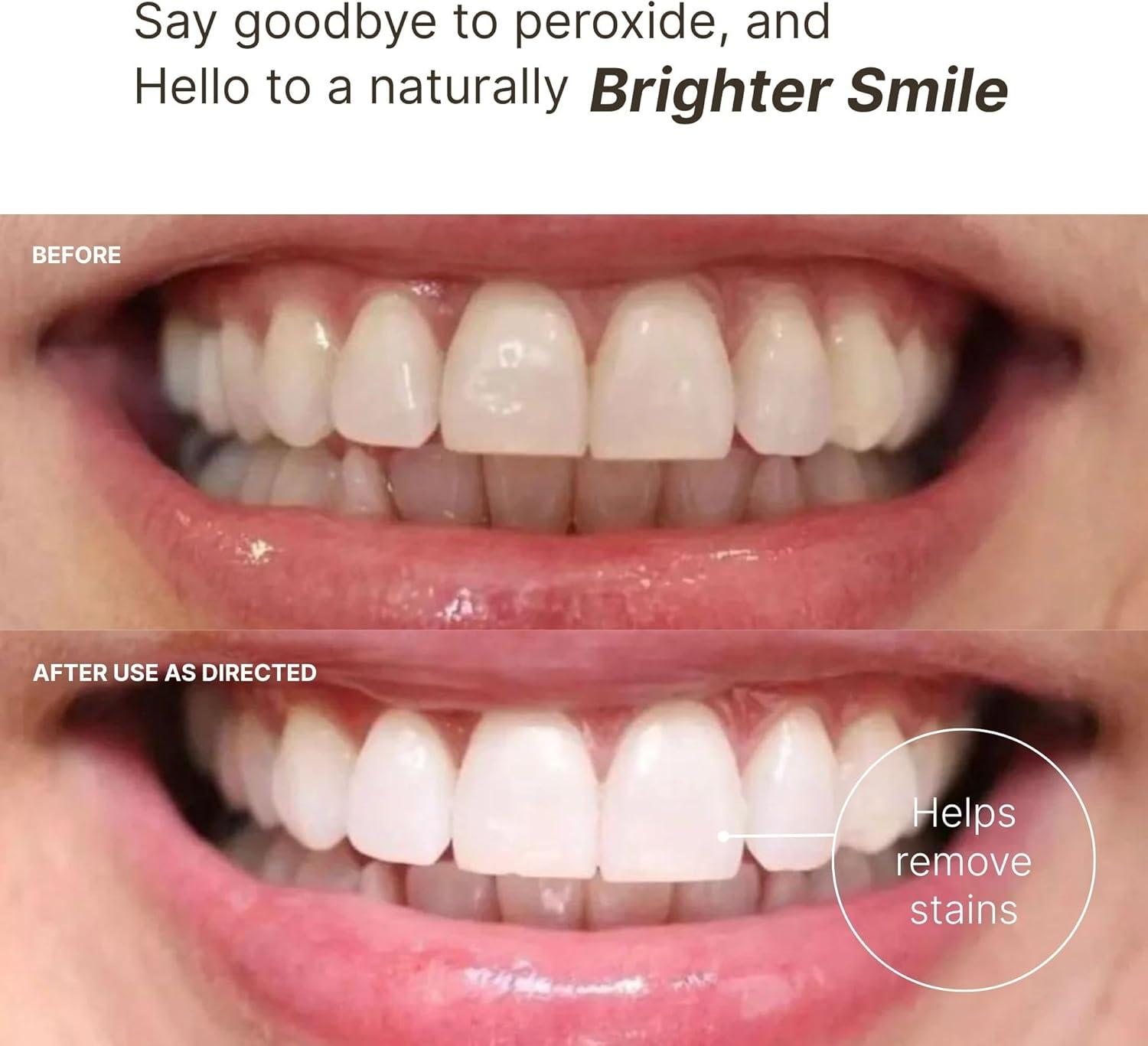 imageNu Skin AP 24 Whitening Fluoride Toothpaste  AP 24 Blend  Vanilla Mint Flavor  Brightens Teeth  Removes Surface Stains  Prevents Dental Cavities ampamp Plaque  EnamelSafe  4 oz  1 PackFluorideFree