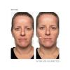 imageNu Skin  Face Lift with Activator Original Formula  Helps Lift and Tighten Your Face and Neck for a Youthful Firm Appearance Reducing Lines and Wrinkles Enhancing Skin Tone and Texture